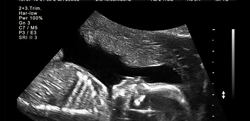 lwv services Ultrasound Scan